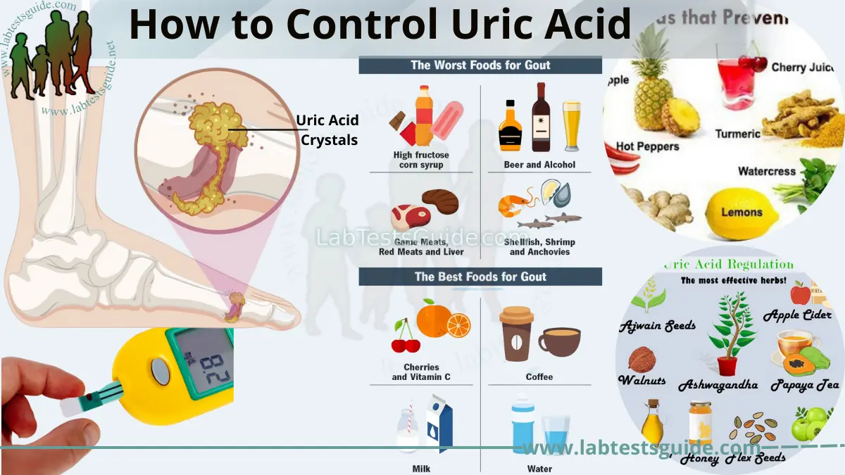 How to Control Uric Acid