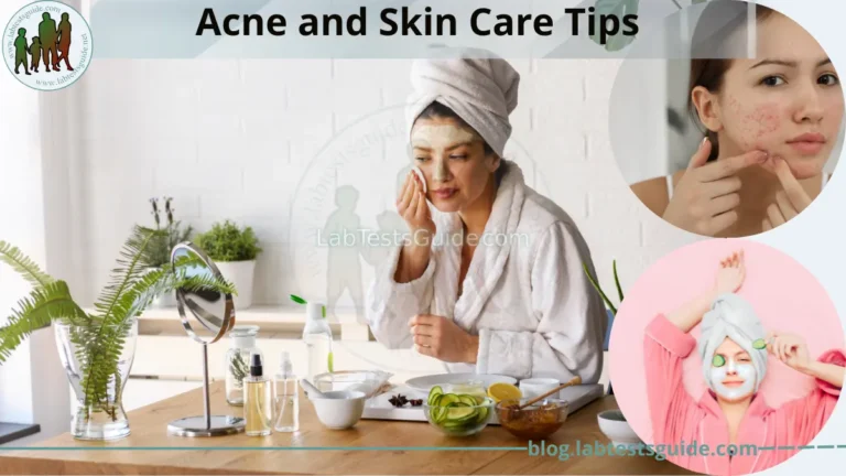 Acne and Skin Care Tips