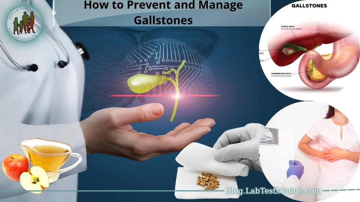 How to Prevent and Manage Gallstones Lab Tests Guide Blog