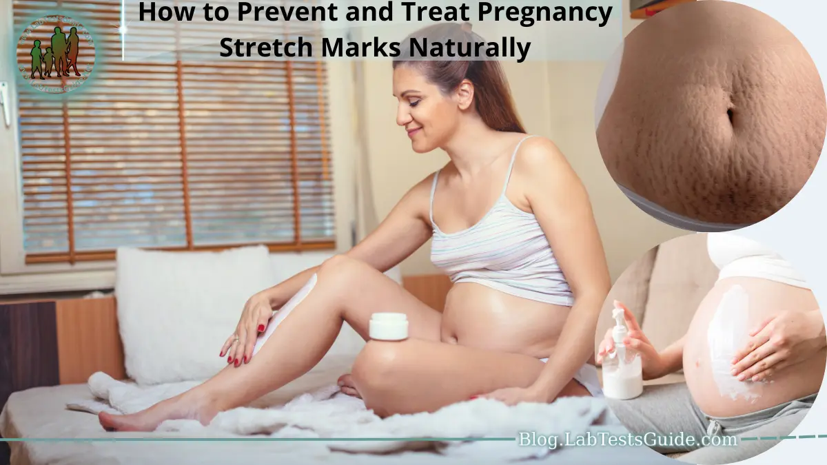 How to Prevent and Treat Pregnancy Stretch Marks Naturally