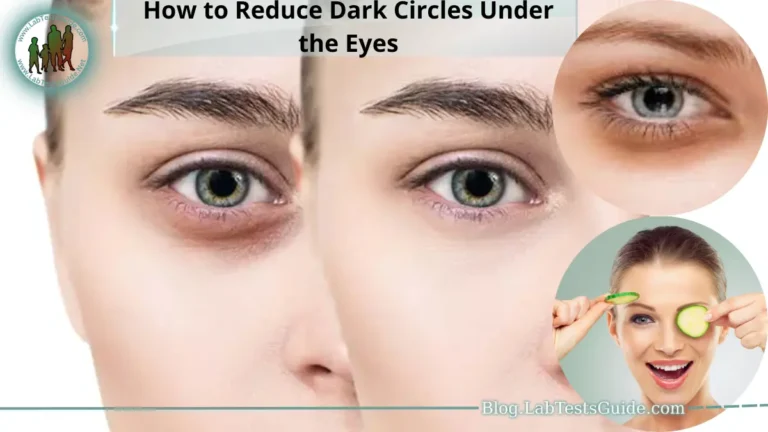 How to Reduce Dark Circles Under the Eyes