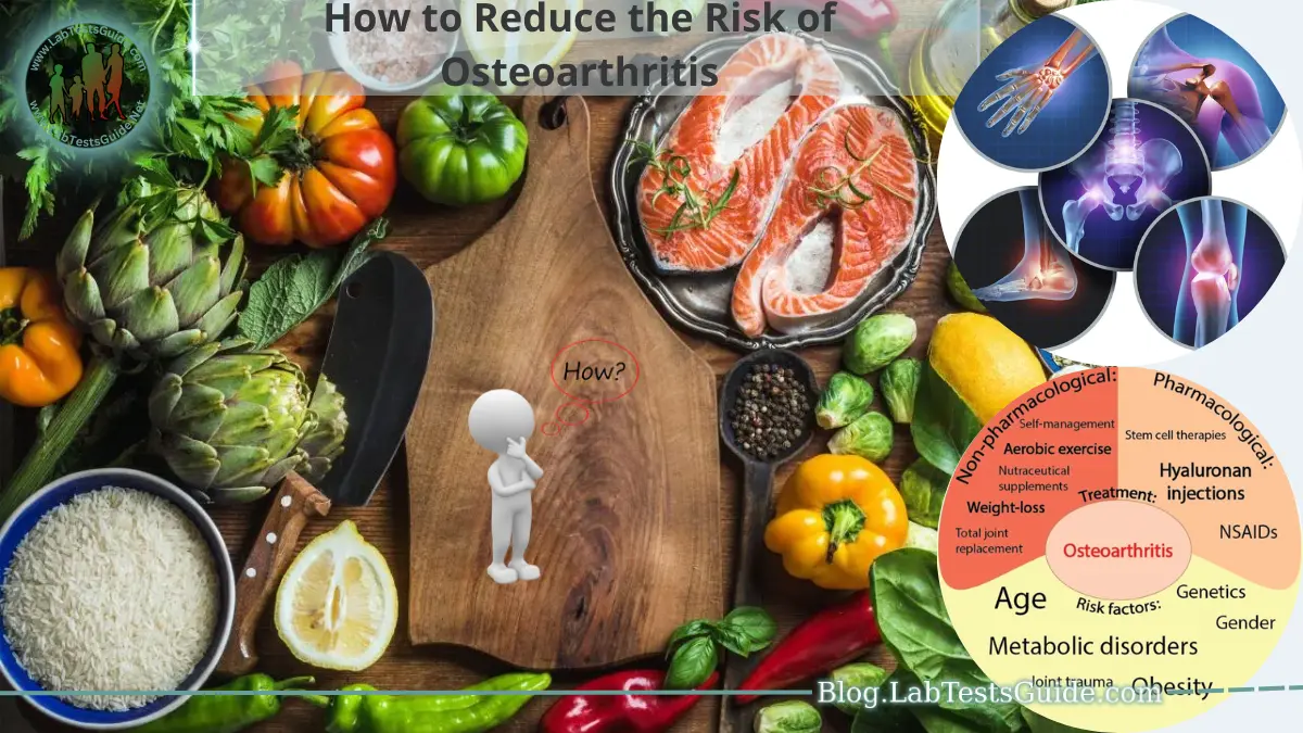 How to Reduce the Risk of Osteoarthritis