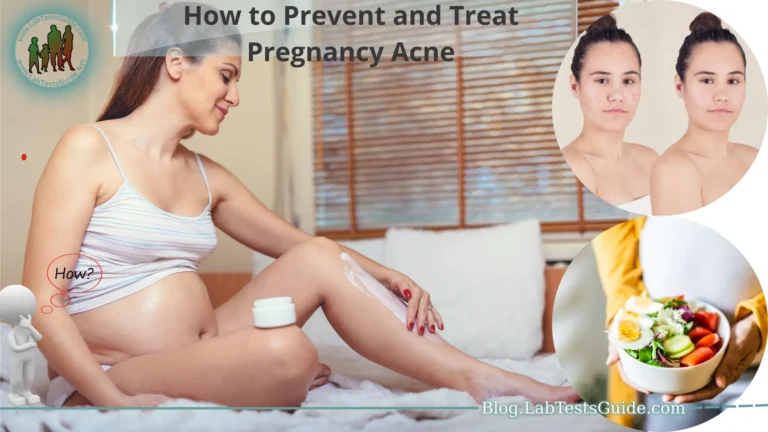 How to Prevent and Treat Pregnancy Acne