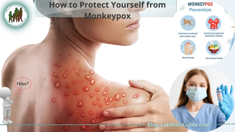 How to Protect Yourself from Monkeypox
