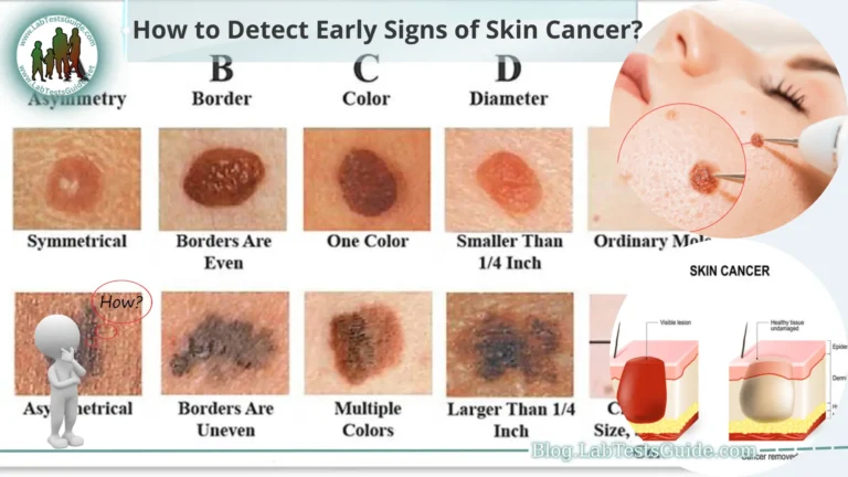 How to Detect Early Signs of Skin Cancer