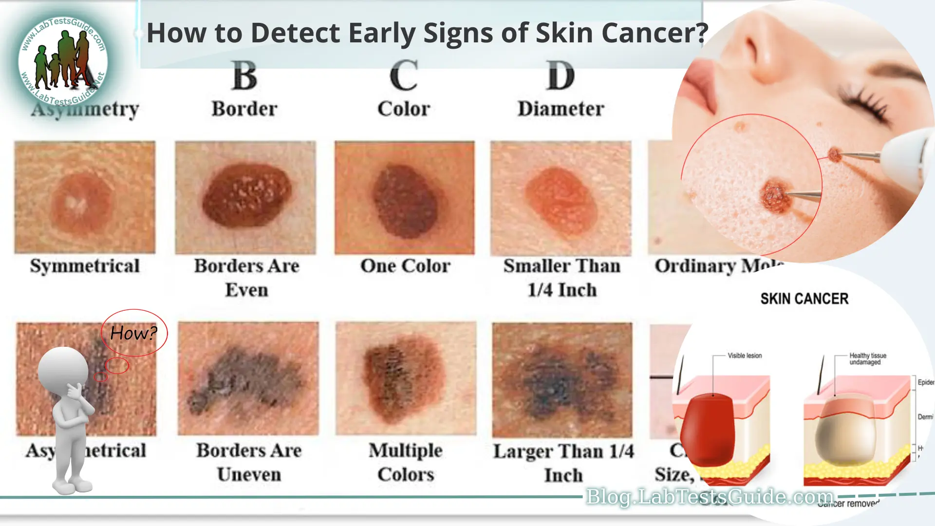 How to Detect Early Signs of Skin Cancer - Lab Tests Guide Blog
