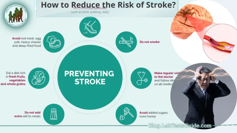 Reduce the Risk of Stroke