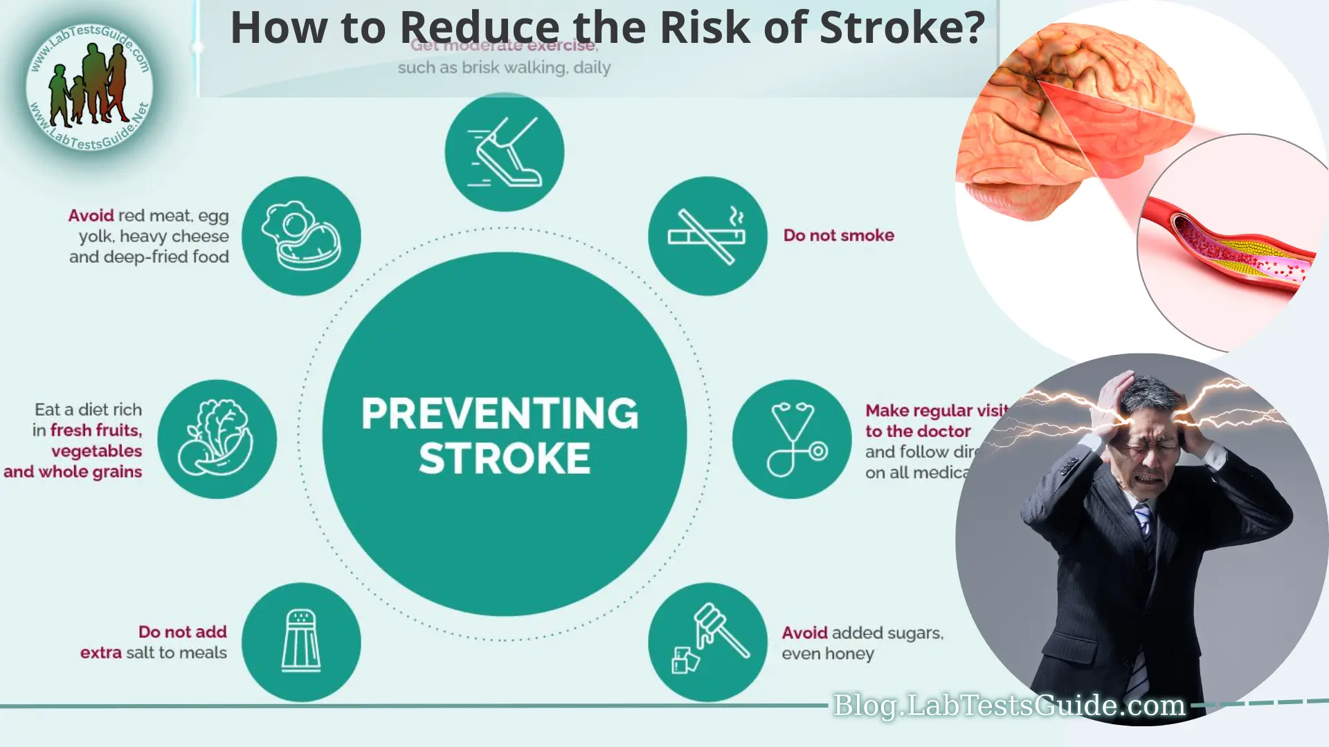 How to Reduce the Risk of Stroke? - Lab Tests Guide Blog