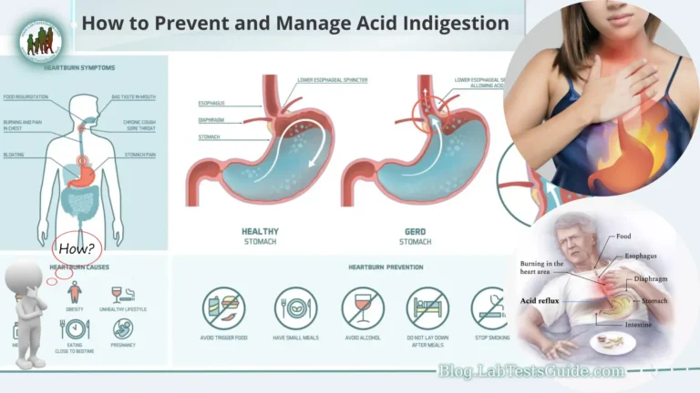 Acid indigestion, also known as heartburn or acid reflux, is a common gastrointestinal condition that affects millions of people worldwide. It occurs when stomach acid flows back into the esophagus, causing a burning sensation in the chest and throat.