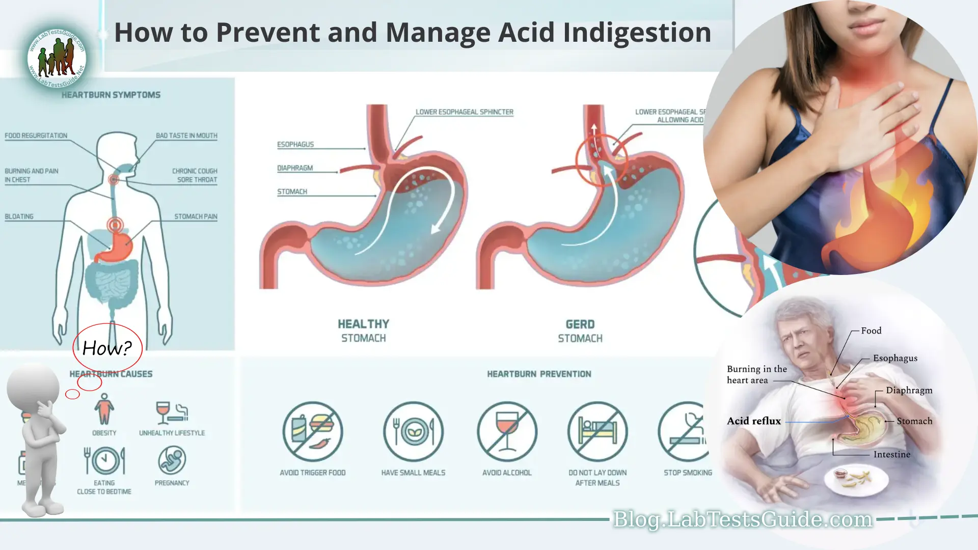 how-to-prevent-and-manage-acid-indigestion-lab-tests-guide-blog