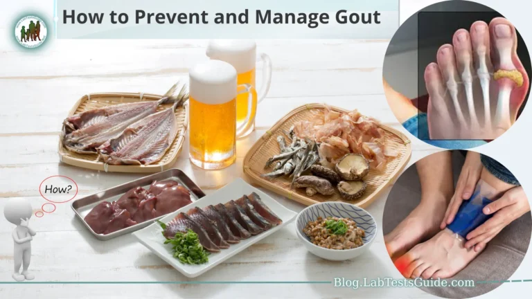 Gout is a complex and painful form of inflammatory arthritis caused by the buildup of uric acid crystals in the joints. It has been known to afflict humans for centuries and continues to be a prevalent health concern worldwide.