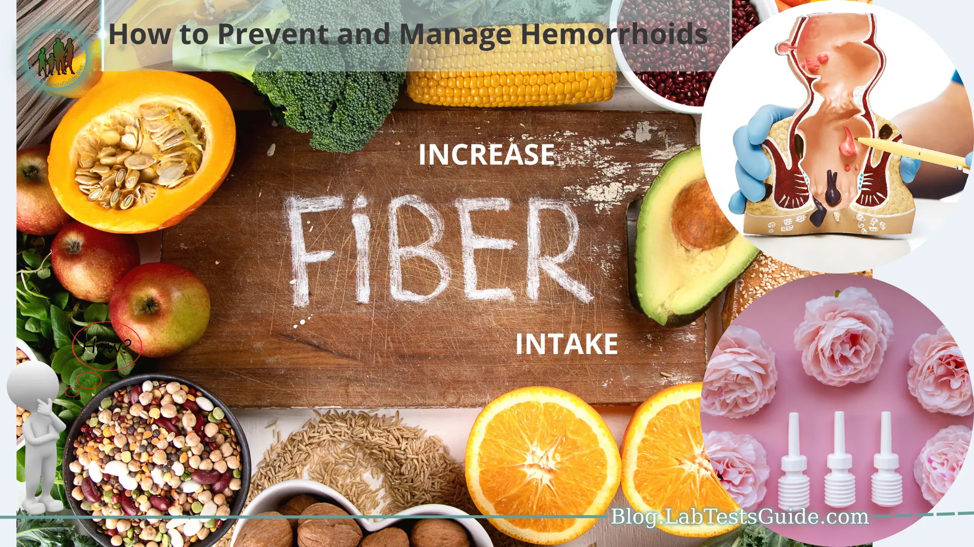 Hemorrhoids, a common yet often uncomfortable and distressing condition, affect millions of individuals worldwide. They are swollen veins in the anal and rectal region that can cause itching, pain, bleeding, and discomfort during bowel movements.