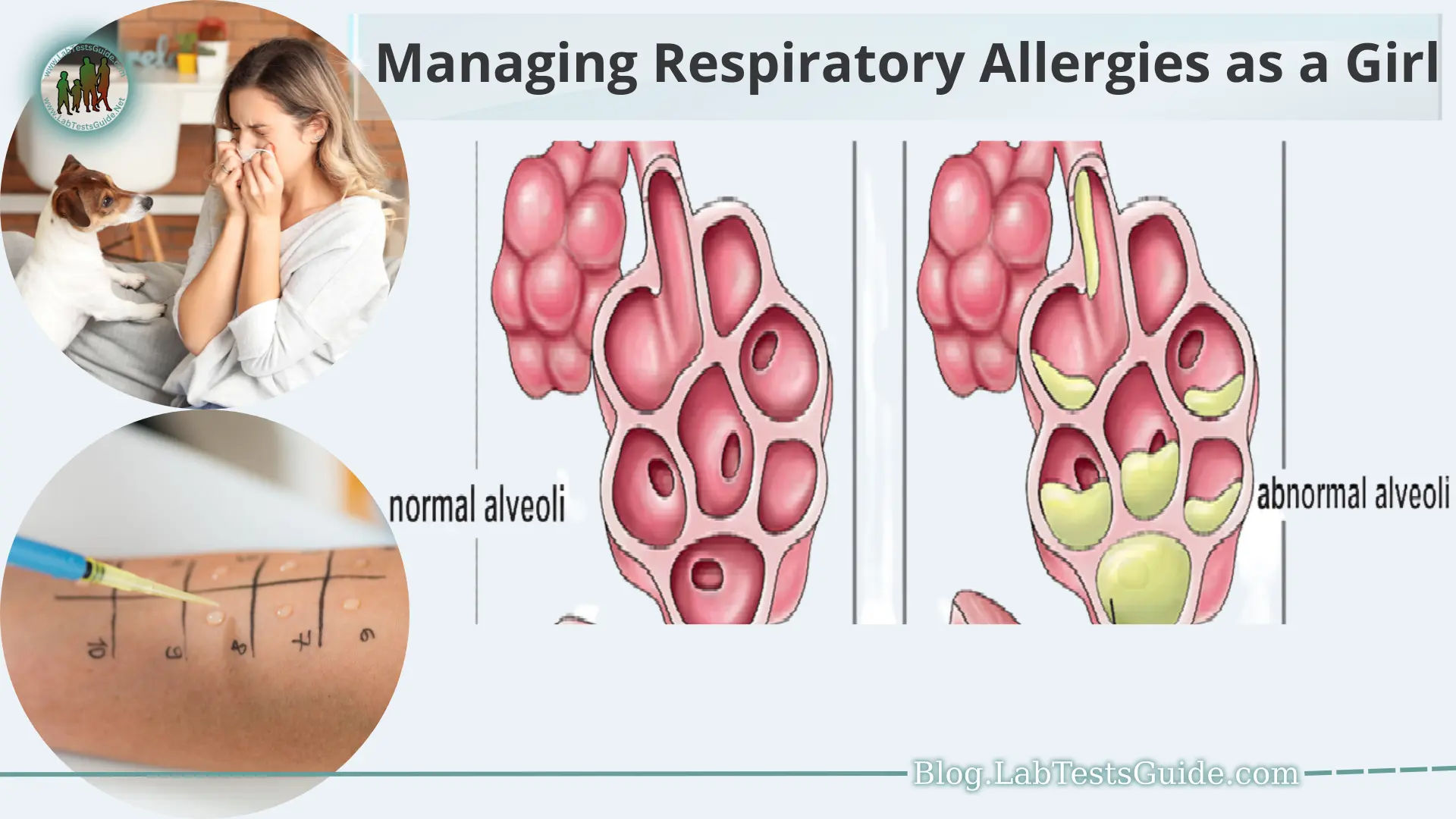 Respiratory allergies can significantly impact the quality of life for individuals, and this includes girls who experience these allergies. Allergies occur when the immune system overreacts to certain substances, known as allergens, leading to a range of respiratory symptoms.